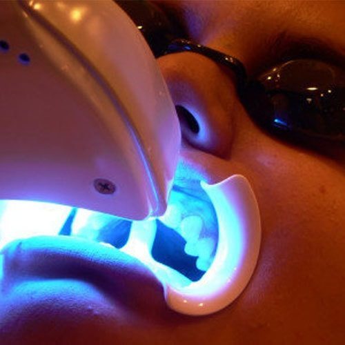 Blanqueamiento Dental en clínica